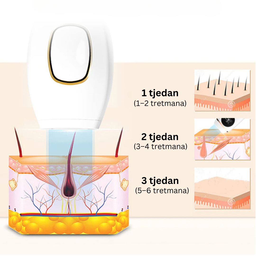 Glowie™ IPL fotoepilator – Uređaj za uklanjanje dlačica