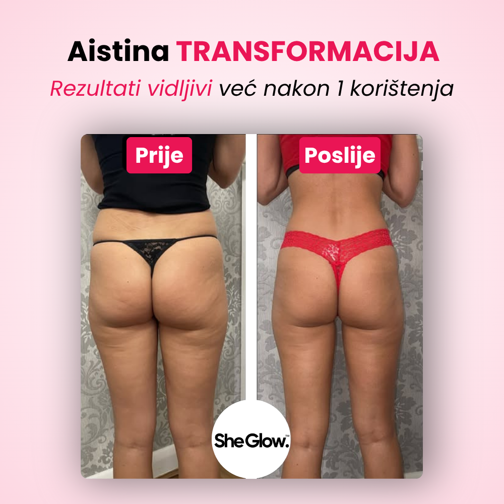 SheGlow™ PRO – set za uklanjanje celulita