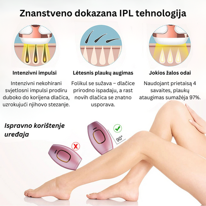 Glowie™ IPL fotoepilator – Uređaj za uklanjanje dlačica